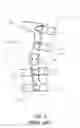 Fig. 02 - Strap tension indicator for orthopedic brace