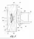 Fig. 04 - Strap tension indicator for orthopedic brace
