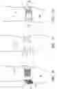 Fig. 07 - Orthopedic brace suspension system
