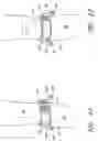 Fig. 09 - Orthopedic brace suspension system