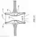 Fig. 03 - Device and method for controlling in-vivo pressure