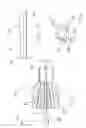 Fig. 03 - Catheter with centering wire