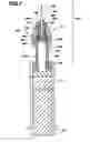 Fig. 07 - Safety syringe