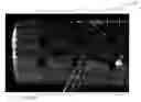 Fig. 04 - Novel instrument for the transplantation of delicate micro-transplants