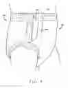 Fig. 05 - Disposable garment having an elastic inner layer with a narrow width in the crotch region