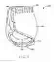 Fig. 07 - Disposable absorbent garment with elastic inner layer having multiple fasteners