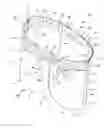Fig. 01 - Absorbent garment having outer shell and discreet absorbent assembly adapted for positioning therein