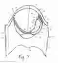 Fig. 07 - Absorbent garment having outer shell and discreet absorbent assembly adapted for positioning therein