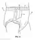 Fig. 05 - Dual-layered disposable garment