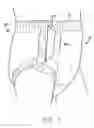 Fig. 06 - Disposable garment having a light framework and flexible waist closure