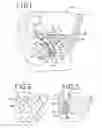 Fig. 02 - Anatomically conforming vaginal insert