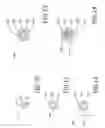 Fig. 12 - Markers for visualizing interventional medical devices