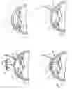 Fig. 02 - Device and method for reshaping the cornea