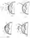 Fig. 03 - Device and method for reshaping the cornea