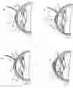 Fig. 04 - Device and method for reshaping the cornea
