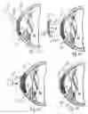 Fig. 08 - Device and method for reshaping the cornea