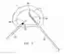 Fig. 04 - Selective delivery of cryogenic energy to intervertebral disc tissue and related methods of intradiscal hypothermia therapy