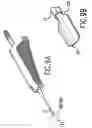 Fig. 07 - Electro-cautery catheter