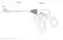 Fig. 01 - Laparoscopic device and method of female sterilization