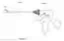 Fig. 02 - Laparoscopic device and method of female sterilization