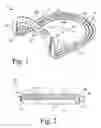 Fig. 02 - External bone/joint fixation device
