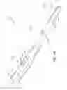 Fig. 03 - Orthopaedic implant and screw assembly