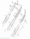 Fig. 07 - Orthopaedic implant and screw assembly