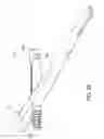 Fig. 10 - Orthopaedic implant and screw assembly
