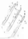 Fig. 07 - Orthopaedic plate and screw assembly