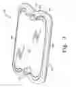 Fig. 04 - Static and dynamic cervical plates and cervical plate constructs