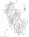 Fig. 06 - Static and dynamic cervical plates and cervical plate constructs
