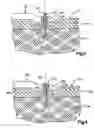 Fig. 03 - Method of securing tissue