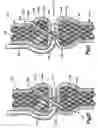 Fig. 06 - Method of securing tissue