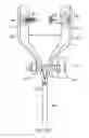 Fig. 06 - Bioabsorbable fasteners for preparing and securing ligament replacement grafts