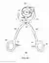 Fig. 08 - Bioabsorbable fasteners for preparing and securing ligament replacement grafts