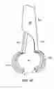 Fig. 10 - Bioabsorbable fasteners for preparing and securing ligament replacement grafts