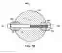 Fig. 15 - Bioabsorbable fasteners for preparing and securing ligament replacement grafts
