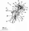 Fig. 02 - Surgical access system and related methods