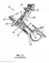 Fig. 18 - Surgical access system and related methods