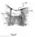 Fig. 29 - Surgical access system and related methods