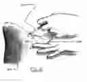 Fig. 34 - Surgical access system and related methods