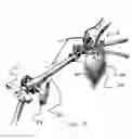 Fig. 43 - Surgical access system and related methods