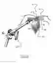 Fig. 44 - Surgical access system and related methods