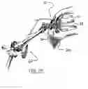 Fig. 45 - Surgical access system and related methods