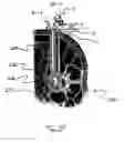 Fig. 48 - Surgical access system and related methods