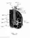 Fig. 49 - Surgical access system and related methods
