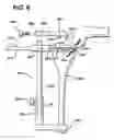 Fig. 08 - Methods and apparatus for orthopedic implant preparation systems