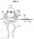 Fig. 09 - Methods and apparatus for orthopedic implant preparation systems