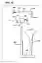 Fig. 10 - Methods and apparatus for orthopedic implant preparation systems