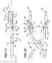 Fig. 11 - Methods and apparatus for orthopedic implant preparation systems